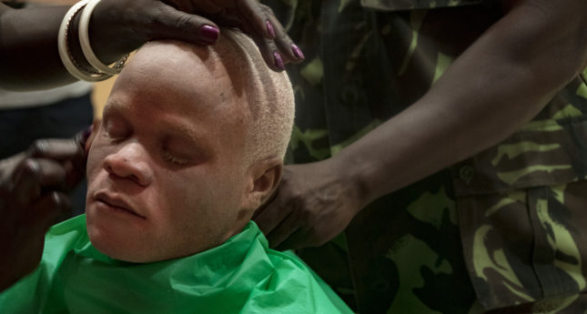 Malawi’s First People With Albinism Pageant